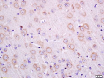 Transmembrane protein 30A Polyclonal Antibody