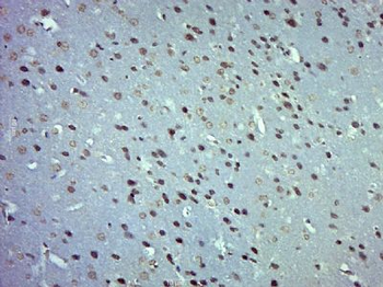 ZNF770 Polyclonal Antibody