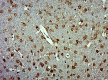 ZSWIM6 Polyclonal Antibody