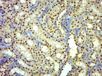 ZSWIM4 Polyclonal Antibody