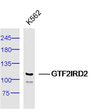 GTF2IRD2 Polyclonal Antibody