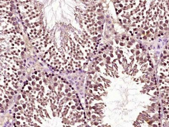GTF2IRD2 Polyclonal Antibody