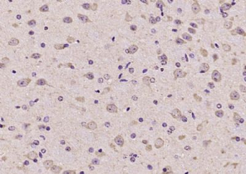 FSIP2 Polyclonal Antibody