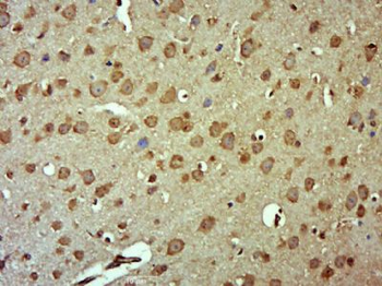 RUFY4/FLJ46536 Polyclonal Antibody