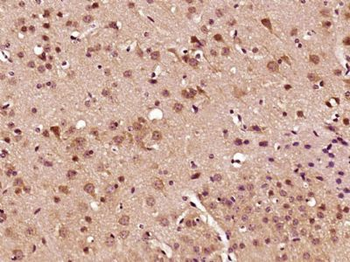 C2orf63 Polyclonal Antibody