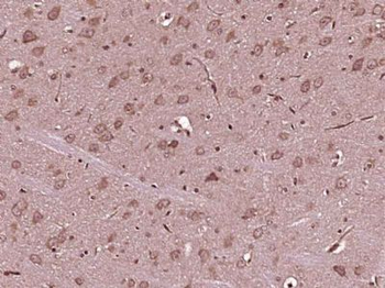 FGD5 Polyclonal Antibody