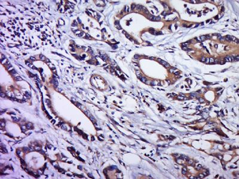 IGFL2 Polyclonal Antibody