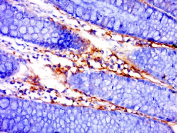 IFNK Polyclonal Antibody
