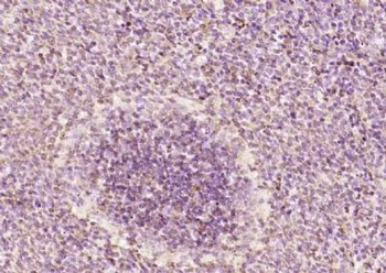 RGS14 Polyclonal Antibody