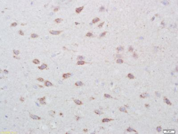 GPR177 Polyclonal Antibody
