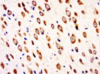 C9orf85 Polyclonal Antibody