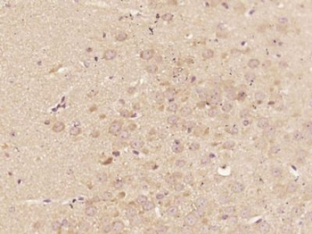 C9orf41 Polyclonal Antibody
