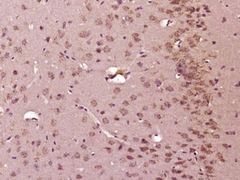 C9orf172 Polyclonal Antibody