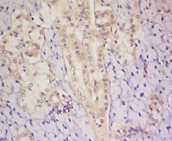 C8orf72 Polyclonal Antibody