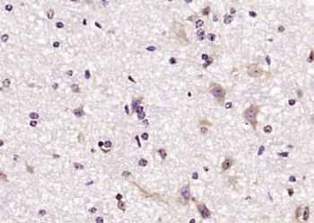C7orf30 Polyclonal Antibody