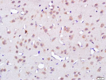 C7orf16 Polyclonal Antibody