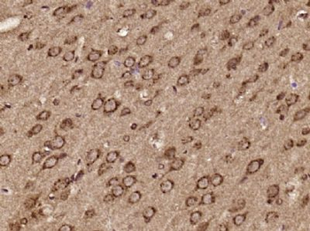 ERMARD Polyclonal Antibody