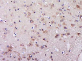C6orf206 Polyclonal Antibody