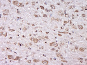 C6orf203 Polyclonal Antibody