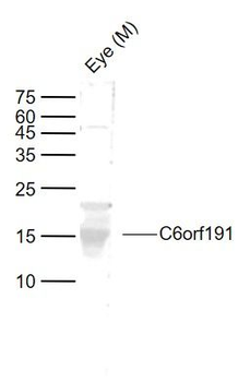 C6orf191 Polyclonal Antibody