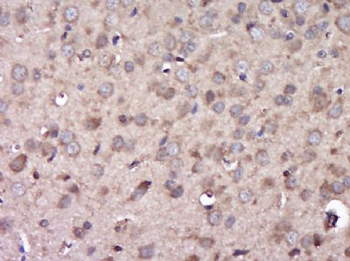 C6ORF154 Polyclonal Antibody