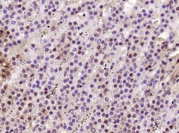 C5orf24 Polyclonal Antibody