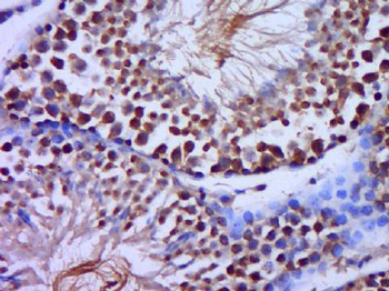 C20orf79 Polyclonal Antibody