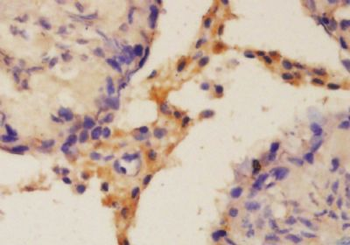 C20orf30 Polyclonal Antibody