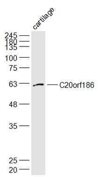 C20orf186 Polyclonal Antibody