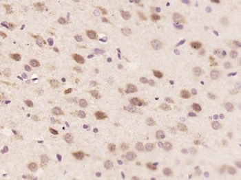 C1orf216 Polyclonal Antibody