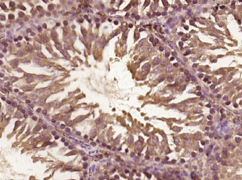 C1ORF190 Polyclonal Antibody