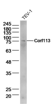C1orf113 Polyclonal Antibody