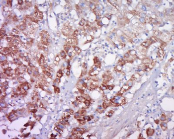FAM47A Polyclonal Antibody