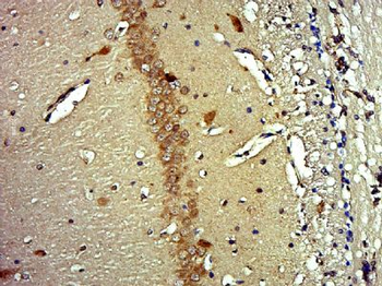 FAM43B Polyclonal Antibody