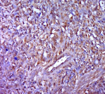 FAM220A Polyclonal Antibody