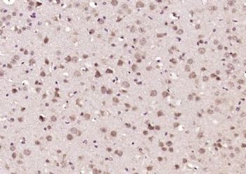 FAM175B Polyclonal Antibody