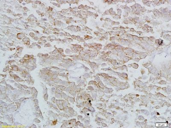 Annexin VI Polyclonal Antibody