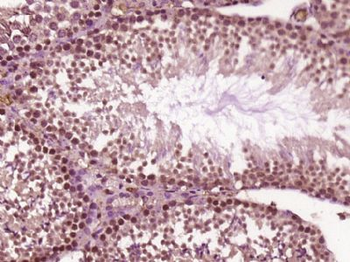 EXOSC5 Polyclonal Antibody