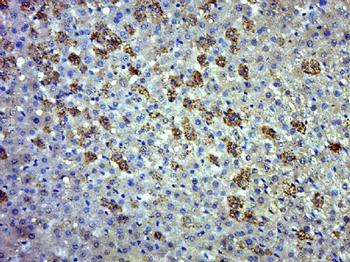 EVI5L Polyclonal Antibody