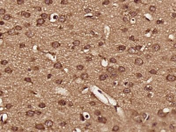 ENDOD1 Polyclonal Antibody