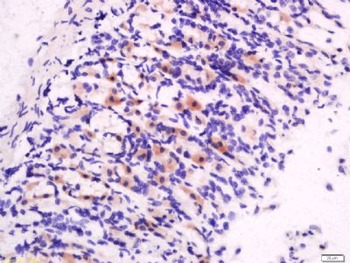 Motilin Polyclonal Antibody