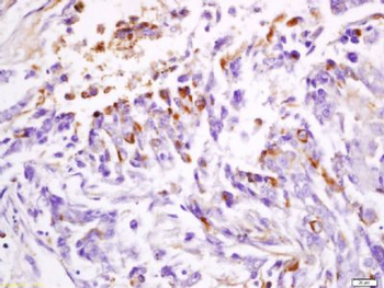 DPM1 Polyclonal Antibody