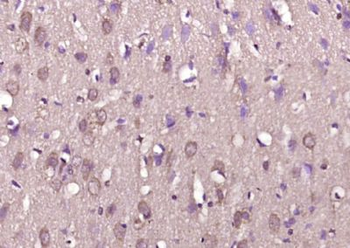DOPEY1 Polyclonal Antibody