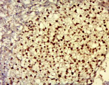 DNAJC21 Polyclonal Antibody