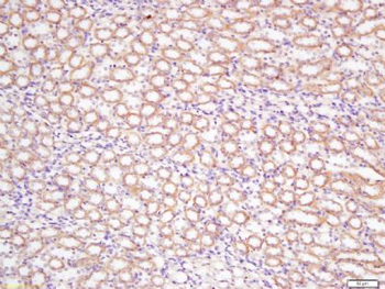 DCTN5 Polyclonal Antibody