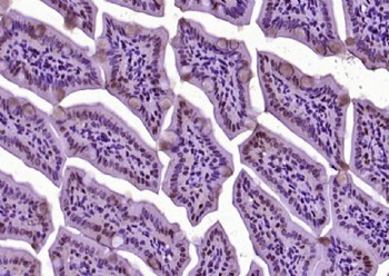 DHDH Polyclonal Antibody