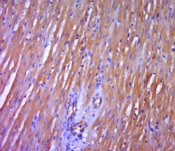 DGKH Polyclonal Antibody