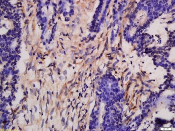DGKH Polyclonal Antibody