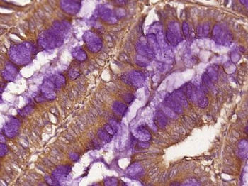 DEFB121 Polyclonal Antibody