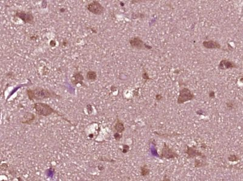 DEFB112 Polyclonal Antibody